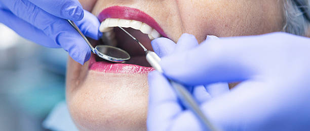Best Walk-In Emergency Dentist in Spring Valley, MN